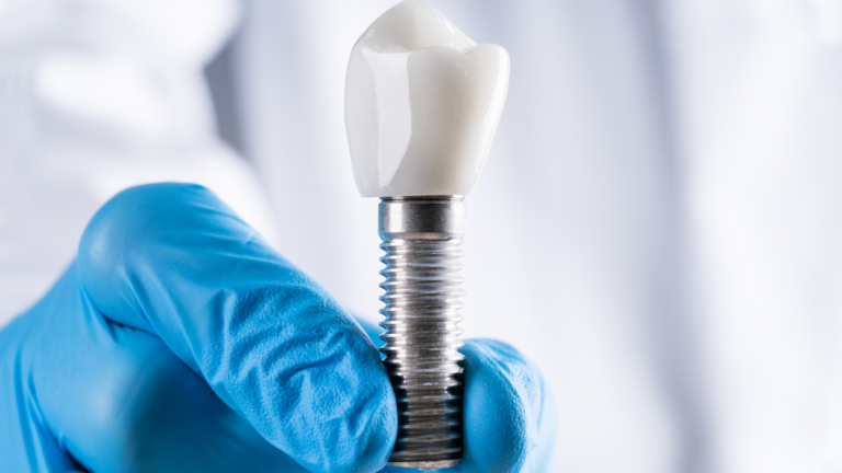 Hutt Dental Implant Centre Brings Specialist Dental Implant Care to Lower Hutt